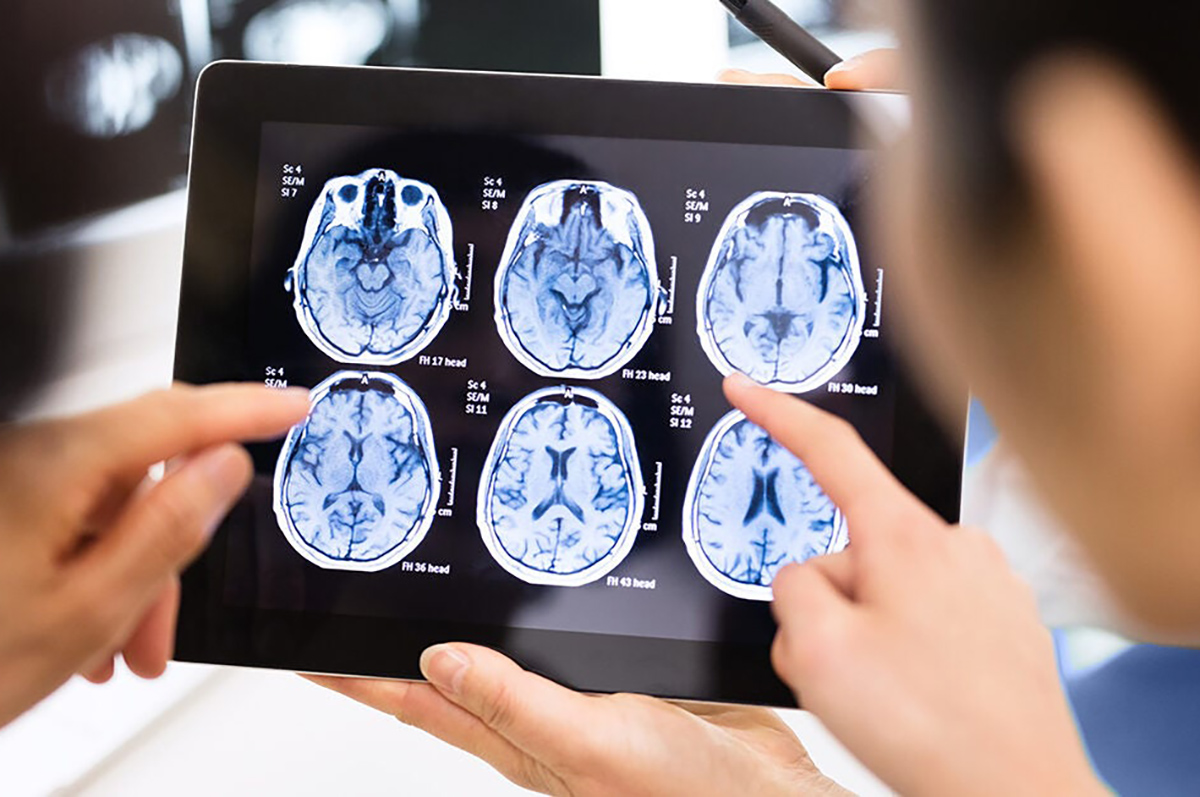 doctor-patient-hands-pointing-brain-scan-digital-tablet-1200x628-facebook-1200x628